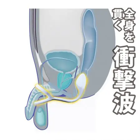 ENEMAGRA UltraBand 前列腺按摩器